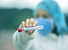 Combate à pandemia requer que profissionais da saúde recebam cuidados